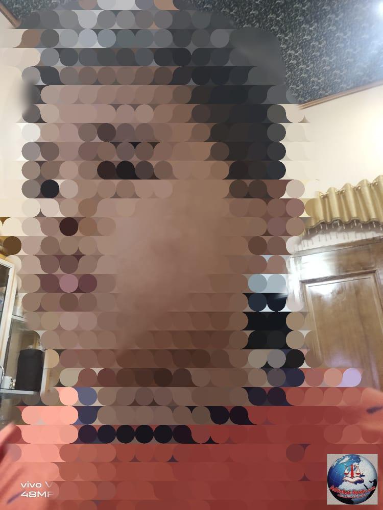 Siswa SDN 01 Gunung Sakti Di keroyok Senior, Di Pukul Hingga Memar