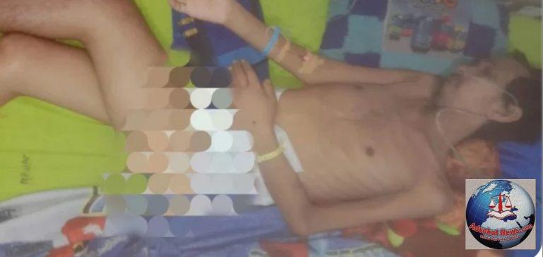 Warga Tuba “Sodri” Butuh Perhatian Dinas Kesehatan dan Dinas Sosial Lantaran Derita Tumor