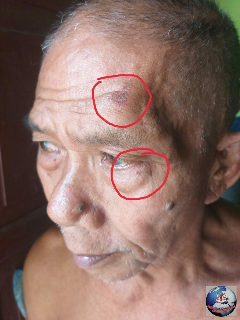 Dua Korban Yang Dianiaya Meminta Kepada Kapolres Bolaang Mongondow Tangkap 9 Pelaku