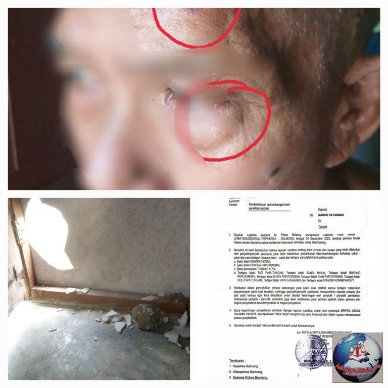 Korban Yang Dikeroyok Oleh 9 Pelaku Akan Mengadu Kepolda Sulut